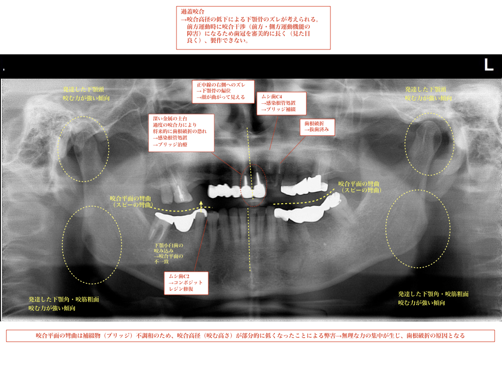 カウンセリングとカウンセリング資料