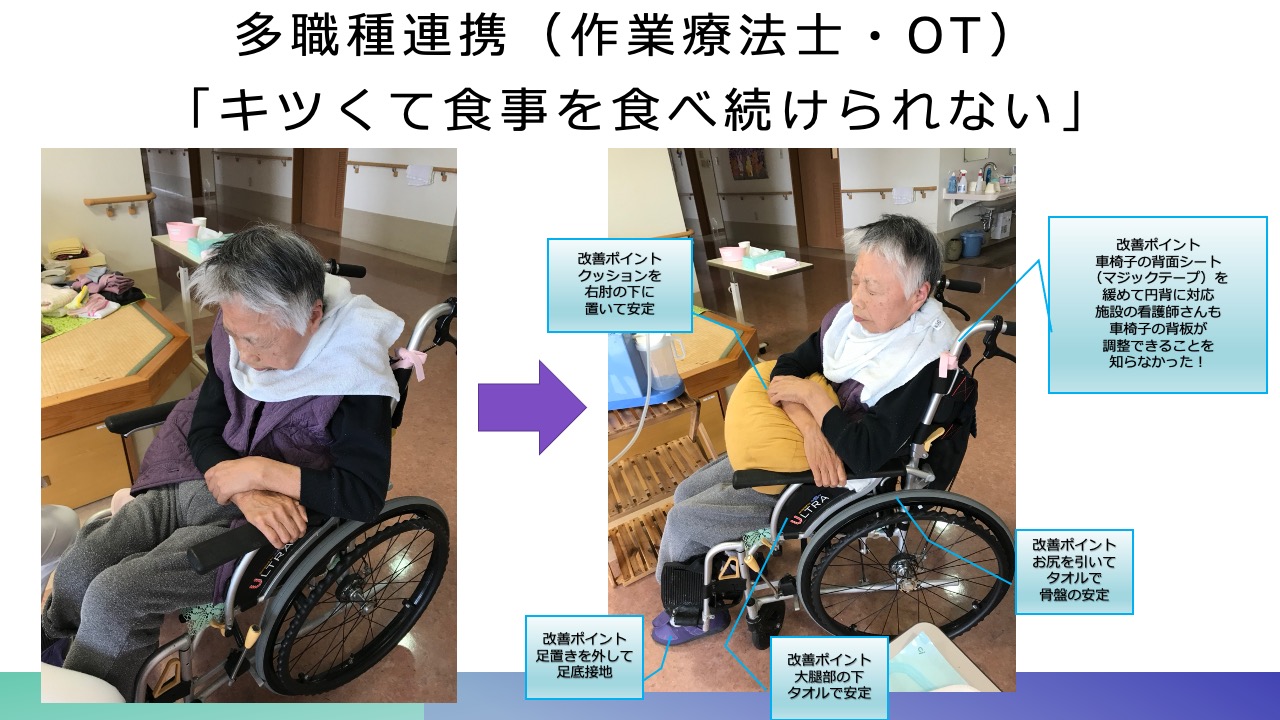 講義「在宅治療における歯科医師の役割」その3