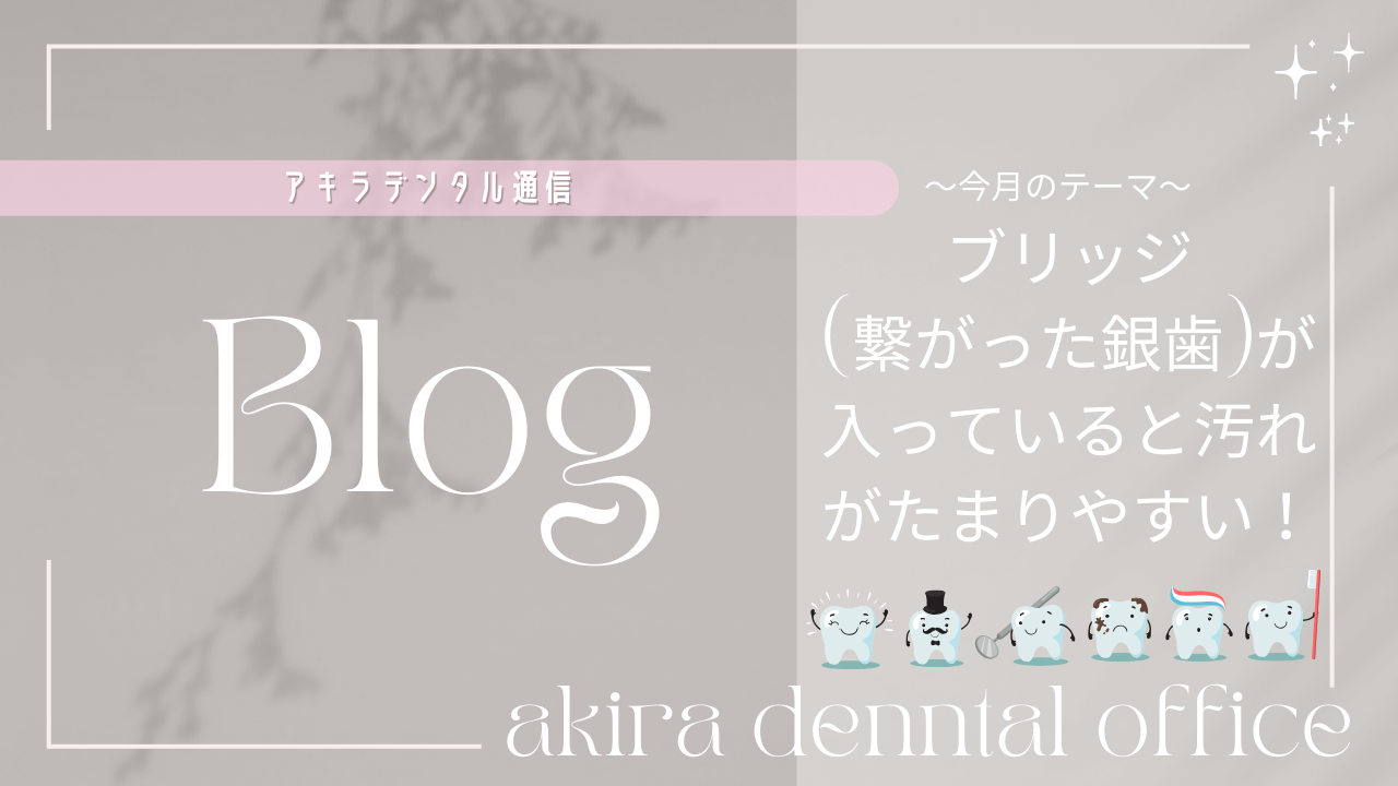 ブリッジ（繋がった銀歯）が入っていると汚れがたまりやすい！