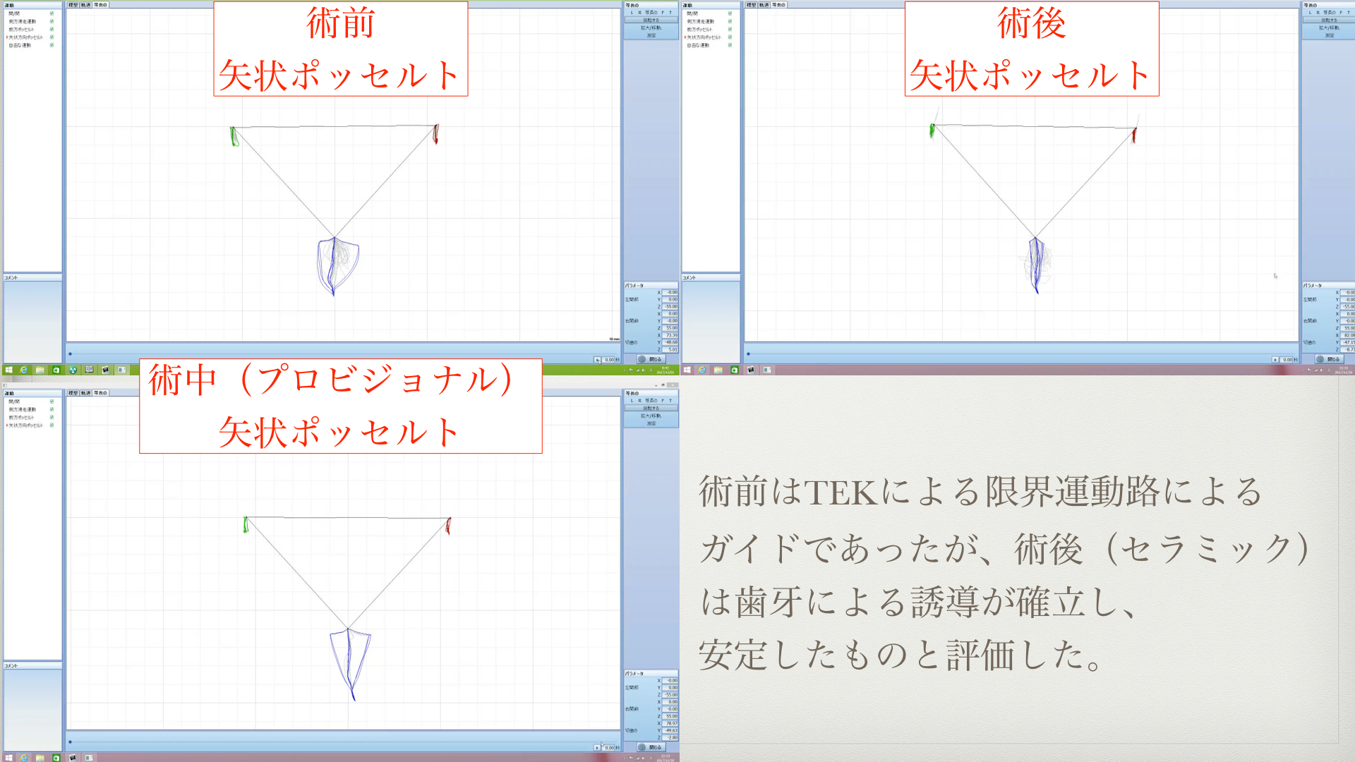 オーバートリートメント（行き過ぎた治療）からのリカバリー（回復）症例