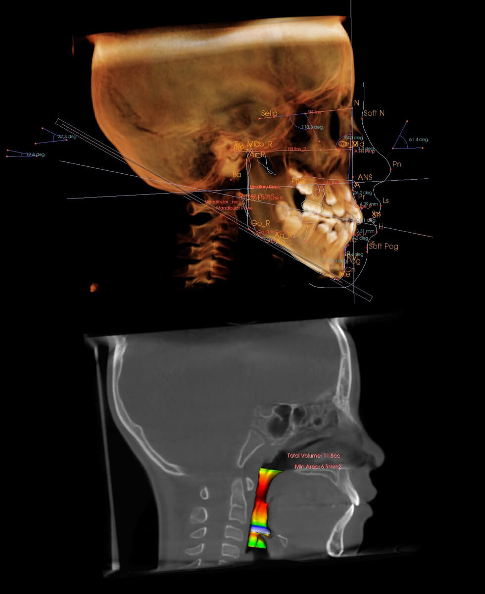 Invivo