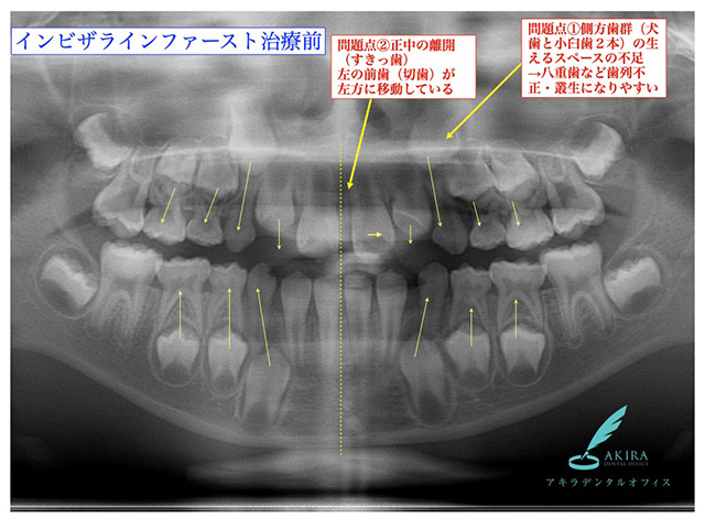 症例紹介