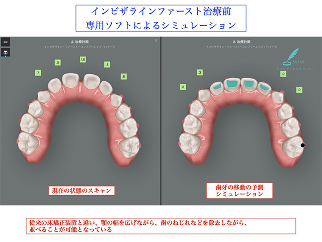 症例紹介