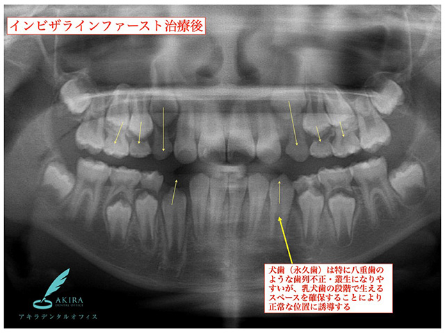 症例紹介